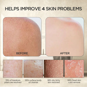 Uso popular como removedor de autobronceado, guantes de baño de viscosa Kessa, guantes exfoliantes para limpieza corporal, <span class=keywords><strong>guante</strong></span> de hammam para cara corporal - Product Image 3