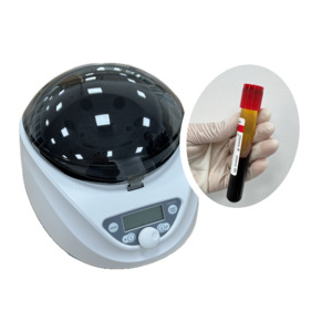 Offres Spéciales PRF 8ml 10ml 12ml 15ml Plasma Riche en Plaquettes/Citrate de Sodium/<span class=keywords><strong>Biotine</strong></span> avec Tube Gel pour PET - Product Image 6