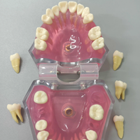 Modèle de réparation d'implant dentaire en résine transparente rose pour l'enseignement de la science médicale et l'enseignement dentaire