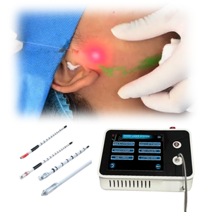 लिपोसक्शन मशीन मूर्तिकार फेलर चेहरे एंडोलेज़र 1470nm 980nm डायोड लेजर लिपोलिसिस कैनुला फाइबर ऑप्टिकल मशीन - Product Image 1