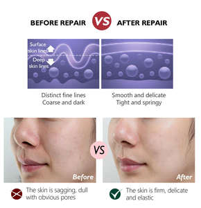 <span class=keywords><strong>Crema</strong></span> de Retinol de Marca Blanca con Vitamina C <span class=keywords><strong>y</strong></span> Ácido Hialurónico, <span class=keywords><strong>Crema</strong></span> Hidratante Nocturna Antienvejecimiento <span class=keywords><strong>para</strong></span> Reafirmar <span class=keywords><strong>y</strong></span> Mejorar las Manchas Oscuras - Product Image 2