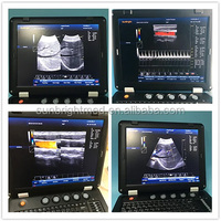 Mesin Ultrasound 3D Canggih untuk Diagnostik Ginekologi dan Tiroid
