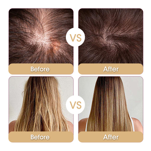 Bán Buôn Tự Nhiên Nhãn Hiệu Riêng 100% Thảo Dược Tự Nhiên Tăng Cường Chống Tóc Mùa Thu Mất Hành Tây Dầu Gội Đầu Và Điều Hòa Thiết Lập - Product Image 6