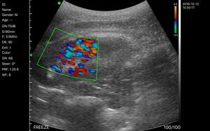 Konted MDR 128E không dây lồi probe Nhà thiết bị siêu âm cho tiết niệu - Product Image 6