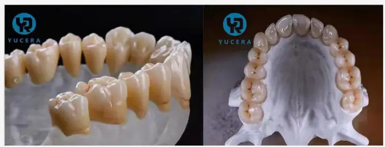 4Dプラス多層ジルコニアブロック歯科インプラント矯正材料多層ジルコニア8層ジルコン歯科用ブロック