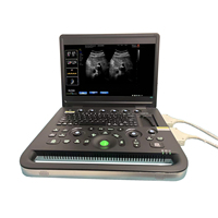 Échographe vétérinaire portable couleur Doppler à succès pour l'imagerie diagnostique vétérinaire