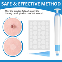 ALIVER Kit de stylo d'élimination des verrues et des acrochordons sans douleur, rapide, sans congélation, sans brûlure, sûr pour usage domestique, pour le visage et le corps