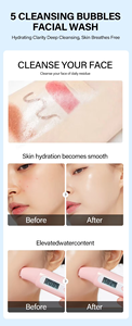 Limpiador facial <span class=keywords><strong>de</strong></span> control <span class=keywords><strong>de</strong></span> aceite <span class=keywords><strong>de</strong></span> máxima resistencia OEM <span class=keywords><strong>10</strong></span>% peróxido <span class=keywords><strong>de</strong></span> <span class=keywords><strong>benzoilo</strong></span> previene espinillas y espinillas textura suave incluso el tono <span class=keywords><strong>de</strong></span> la piel - Product Image 5