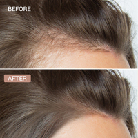 Sérum de croissance des cheveux anti-chute de cheveux de marque privée OEM ODM