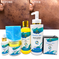 Nouvel Ensemble de Soins du Visage Coréens Personnalisé OEM à la Carotte, Biologique et Naturel, Blanchissant et Hydratant, pour Éliminer les Taches Brunes