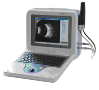Échographe ophtalmique ABS-300 A/B avec sonde 10 MHz, formule IOL, mode immersion/contact pour clinique ophtalmique