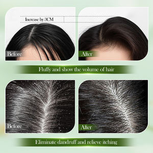 OEM al por mayor limón <span class=keywords><strong>jengibre</strong></span> champú limpieza profunda hidratante nutritivo suavizante anticaspa refrescante champú orgánico para el cabello - Product Image 5
