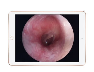 Exklusives 4k drahtloses endoskopisches Veterinär kamerasystem für den Tier gebrauch - Product Image 6