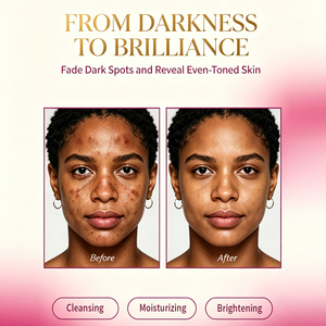 Soin Visage Correcteur Anti-Taches Sombres Nettoyant Doux Marque Privée Éclaircissant Beauté Peau Lumineuse Élimination des Taches Sombres - Product Image 4