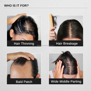 オウムオーガニックハーバルジンジャーエッセンシャルオイルオイル頭皮血清栄養ビオチン育毛製品トリートメント育毛血清 - Product Image 4