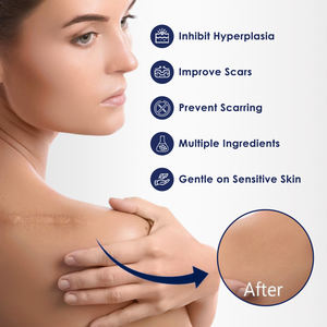 Label privé élimination des cicatrices décoloration réparation des imperfections corporelles hydrater la peau lisse ampoule sérum d'élimination des cicatrices 2ml * 5 bâtons - Product Image 5