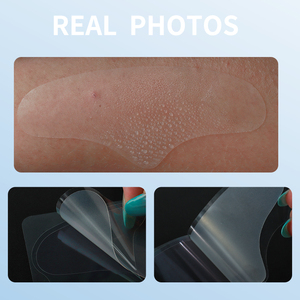 Fabrication de patchs anti-boutons OEM, soin des imperfections, traitement des imperfections, autocollant hydrocolloïde, peau grasse, anti-transpiration, patch anti-acné coréen, patch anti-boutons - Product Image 6
