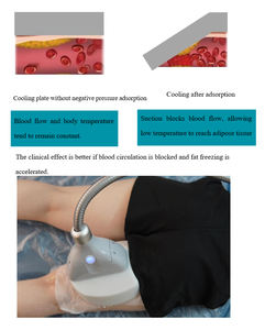 เครื่องแช่แข็งไขมันอเนกประสงค์ ปี 2026 กำจัดเซลลูไลท์ สำหรับร้านเสริมสวย - Product Image 6