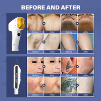 Perfectlaser - Machine professionnelle de suppression des poils au laser diode 2 en 1 pour salon de beauté, spa et location commerciale