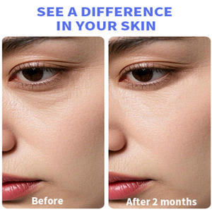 Correcteur de cernes et traitement anti-poches pour les yeux, Gel instantané énergisant pour les yeux, Hydratant rafraîchissant et décongestionnant à la Yerba Mate et à la caféine - Product Image 4