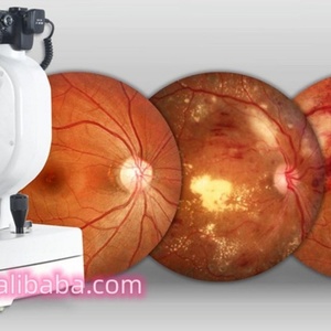 Caméra de fond d'œil automatique YDC09 à bas prix, caméra FFA / caméra de rétine, photographie de fond d'œil non mydriatique pour l'ophtalmologie - Product Image 3