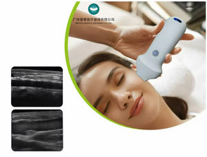 Échographe <span class=keywords><strong>portable</strong></span> sans fil C37G Clinic à haute fréquence pour l'analyse des couches et structures du visage, scanner d'imagerie couleur pour interventions esthétiques - Product Image 1