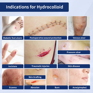 ضمادات هيدروكولويد ذاتية اللصق فائقة الامتصاص ومقاومة للماء من هواويل لعلاج حب الشباب والبثور بحجم وتغليف مخصص - Product Image 2