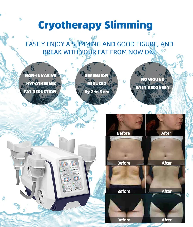 New trending fat cell reduction painless cellulite removal 360 cryo machine for body slimming 5 cups