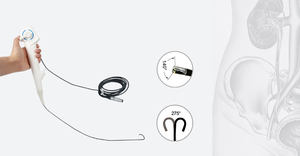 Equipos médicos Endoscopio Precio de fábrica Flexible Sing-use Flexible <span class=keywords><strong>Desechable</strong></span> Video Cámara endoscópica para Urología - Product Image 4