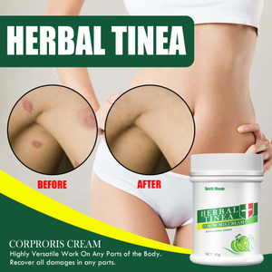 Crème à base de plantes South Moon Tinea Corproris pommade externe douce et non irritante pour soulager <span class=keywords><strong>les</strong></span> démangeaisons du corps - Product Image 5