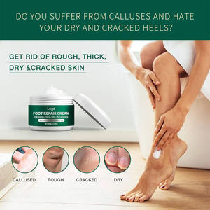 Crème <span class=keywords><strong>Anti</strong></span>-fongique hydratante et adoucissante, produit de marque privée, exfoliante et blanchissante, pour les talons de pieds secs craquelés - Product Image 3