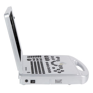 Sonda de Ultrasonido Inalámbrica a Color de Doble Cabezal Portátil para Hospital <span class=keywords><strong>Doppler</strong></span>, Instrumento de Diagnóstico por Ultrasonido a Color - Product Image 4