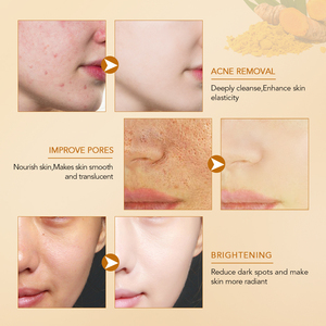 Toptan özel etiket zerdeçal kızdırma kil maskesi arındırıcı zerdeçal kil maskesi C vitamini zerdeçal kil maskesi - Product Image 6