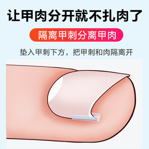 Dispositivo de corrección de uñas encarnadas para niños con parche de aislamiento - Product Image 4
