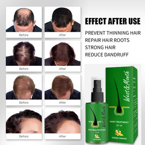 OEM西月ヘアケアハーバルリグレース抗損失ギンセンビオチン育毛オイルグリーンジンジャーヘアエッセンシャルオイル - Product Image 2