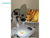 Microscope Chirurgical Dentaire Portable à Zoom Continu 5X-33X, Caméra d'Opération Dentaire Harbor Dent - Offre Spéciale