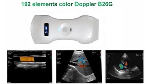 Sonde échographique convexe linéaire 3-en-1 à 192 éléments, la plus avancée, pour <span class=keywords><strong>scanner</strong></span> vasculaire portable vétérinaire et humain, compatible avec les appareils iOS, Android et Windows - Product Image 2