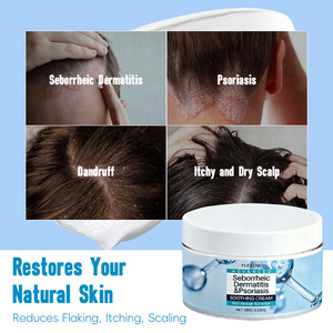 Crème capillaire à base de plantes en gros pour le psoriasis, la <span class=keywords><strong>dermatite</strong></span> séborrhéique, antipelliculaire, réparatrice des démangeaisons, marque privée OEM - Product Image 4