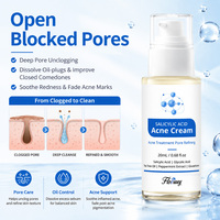 Crème éclaircissante pour le visage à l'acide salicylique, soin anti-acné, éclaircissement du teint, atténuation des marques d'acné, contrôle du sébum, hydratant pour peaux sensibles, OEM