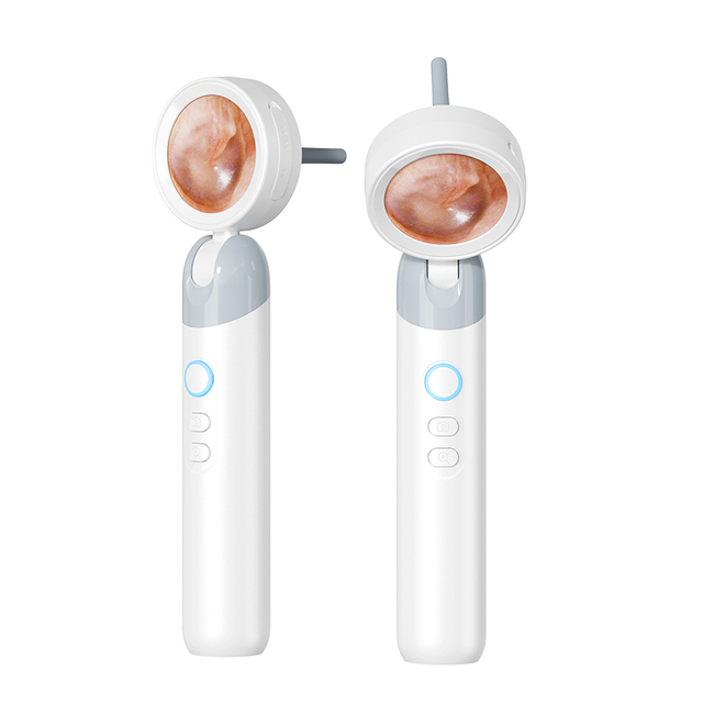 SUNUO 2025 Kids Pets Use 1080p HD Smart Ear Canal Detector Ear Camera With 1.38inch Smart Screen for Home Use