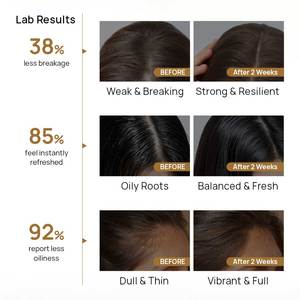 Oil Control Hydrating Anti Loss Hair <strong>Shampoo</strong> <strong>With</strong> Ginger Balanced Scalp Long Lasting Refreshing <strong>Moisturizing</strong> <strong>Shampoo</strong> - Product Image 4