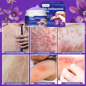Crema de 20g para Aliviar Picaduras de Mosquitos, Psoriasis, Dermatitis, Eccema, Cuidado de la Piel, Antiprurito Efectivo - Product Image 3