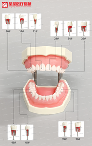 Tal y como se ve, OOT Pulpa de ndo-, no se puede utilizar, ULP - Product Image 2