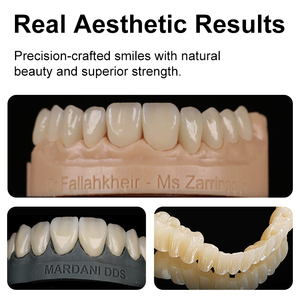 Matériaux de fraisage céramique Ownsmile haute résistance 900mpa SHT-C 10-30MM 95MM, blocs de zircone Cad Cam - Product Image 2