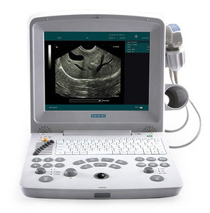 Máquina de Ultrasonido Veterinaria Edan DUS 60, Precio de la Máquina de Ultrasonido Veterinaria DUS60, Ultrasonido Portátil Veterinario en Blanco y Negro - Product Image 2