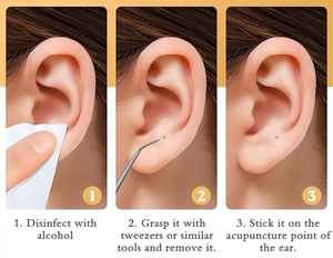 بذور الأذن القابل للتصرف متعدد الحالات تحفيز الأذن التصحيح بذور الأذن الصحافة - Product Image 4