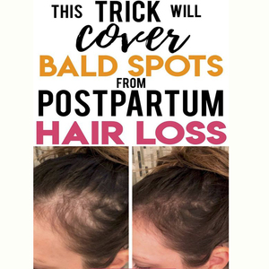 Set <span class=keywords><strong>Shampoo</strong></span> e Siero ARGANRRO per Trattamento Anticaduta e <span class=keywords><strong>Antiforfora</strong></span>, Riduce il Prurito e Stimola la Crescita dei Capelli - Product Image 2