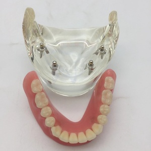 Modelo de cirugía dental y oral para nuevos productos de ciencia médica de implantación y Prostodoncia - Product Image 2