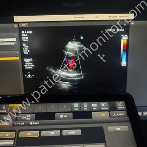 Transductor de Sonda de Matriz Faseada S8-3 para Máquinas de la Serie EPIQ, 3.0 MHz - 8.0 MHz - Product Image 6