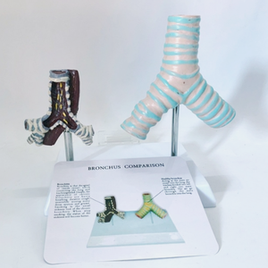 Modelo Comparativo de Tráquea Humana Saludable y Tráquea Dañada por el Tabaco - Product Image 5